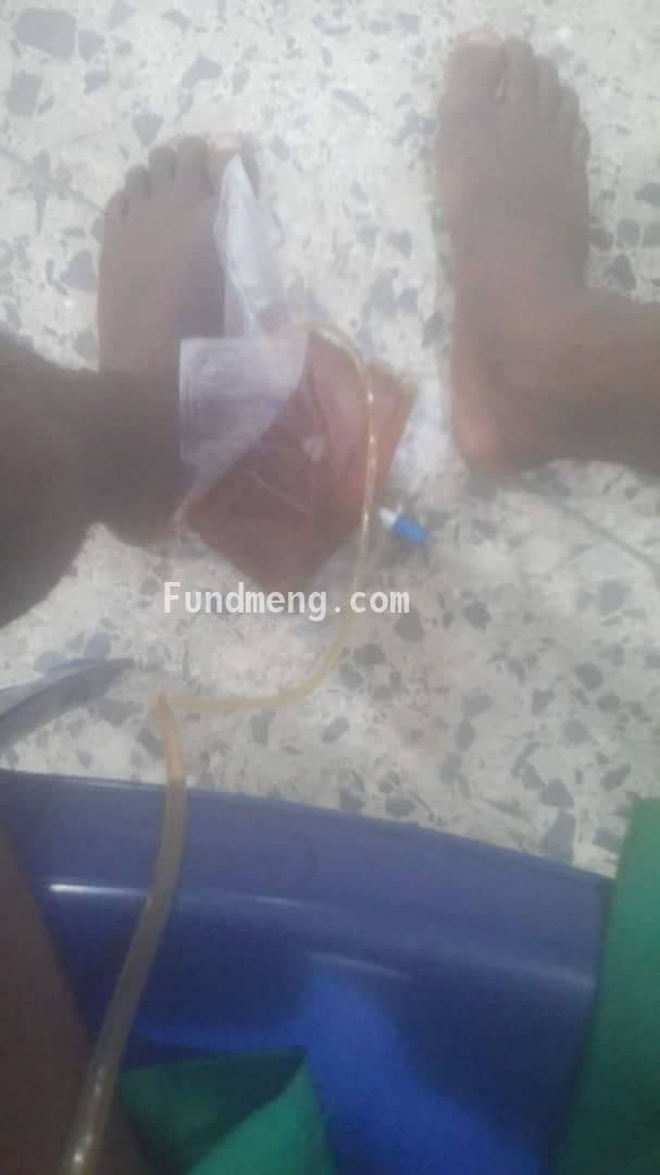 Orji an orphan needs help to walk again