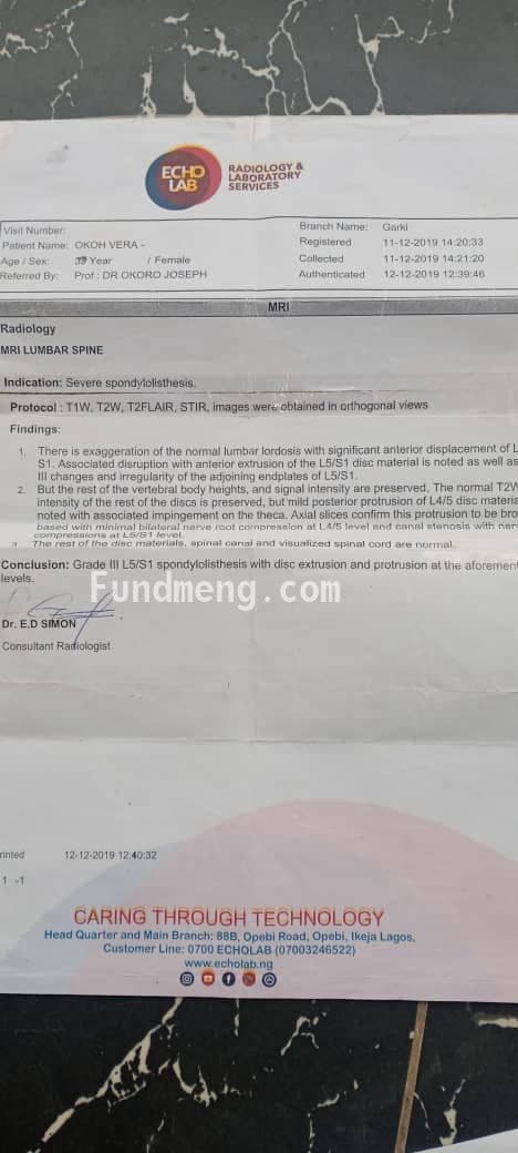 Please lets help Okoh Vera curb LUMBAR SPINE. A severe case of spondylolisthesis. She needs to be operated