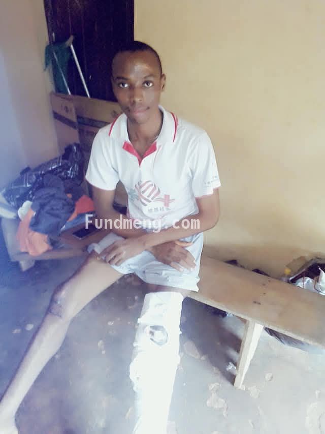 Help Chima Chigbo Michael (a.k.a OBAMA)  To get a knee cap surgery to be able to recover from a fatal accident and get a new knee cap surgery as the former is completely damaged;  I am here to reach out to the GENERAL PUBLIC PLEASE