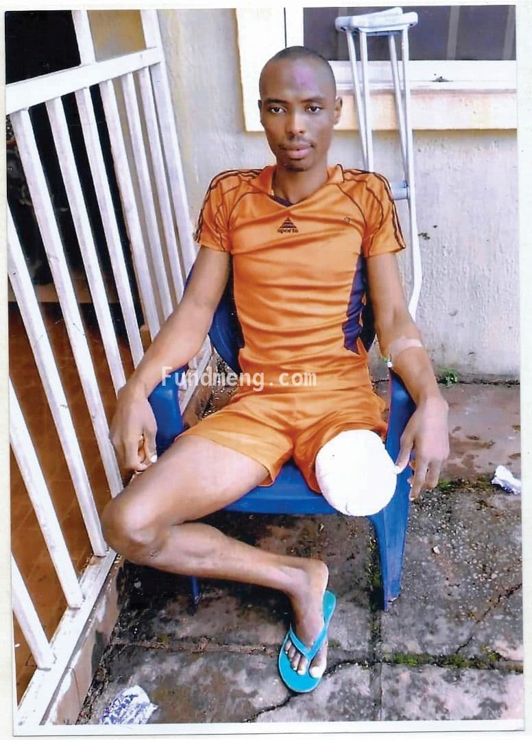 Help Chima Chigbo Michael (a.k.a OBAMA)  To get a knee cap surgery to be able to recover from a fatal accident and get a new knee cap surgery as the former is completely damaged;  I am here to reach out to the GENERAL PUBLIC PLEASE