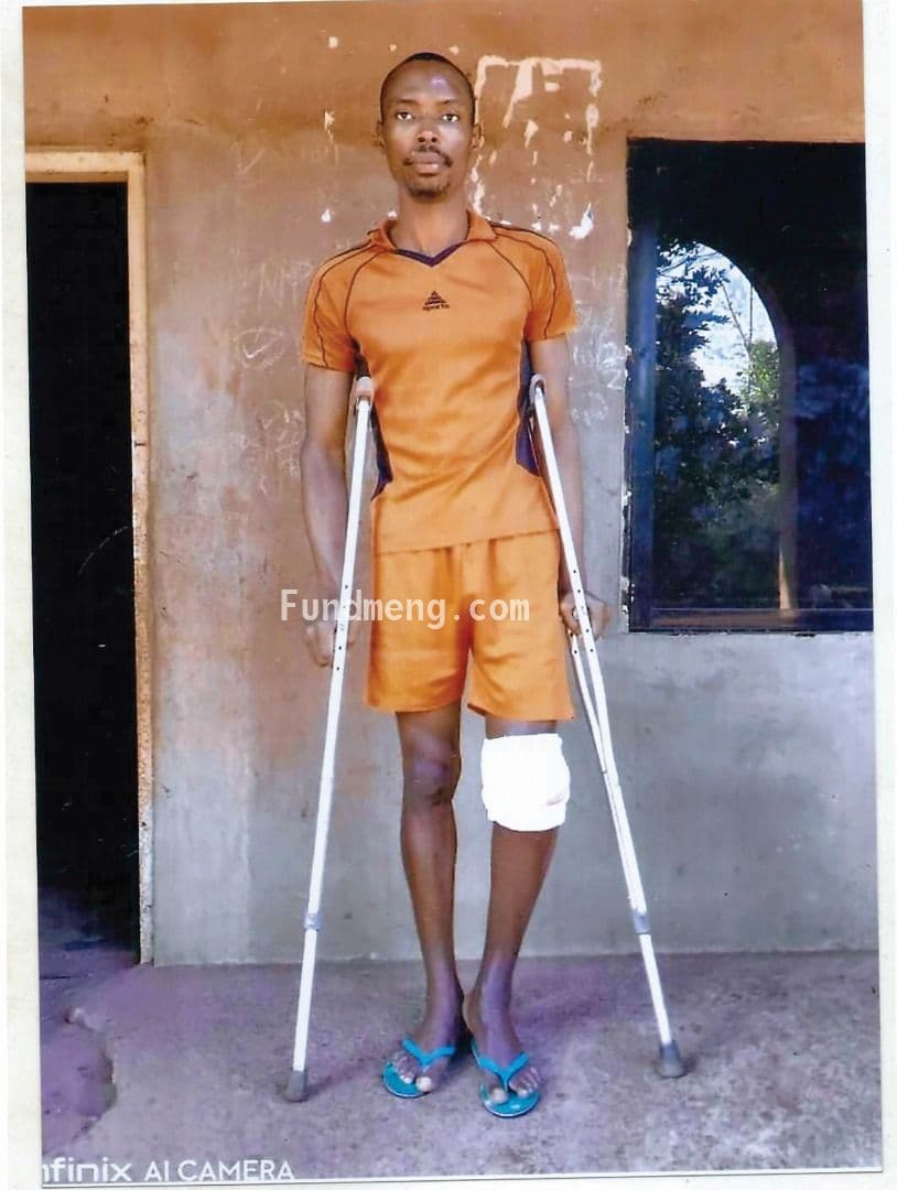 Help Chima Chigbo Michael (a.k.a OBAMA)  To get a knee cap surgery to be able to recover from a fatal accident and get a new knee cap surgery as the former is completely damaged;  I am here to reach out to the GENERAL PUBLIC PLEASE