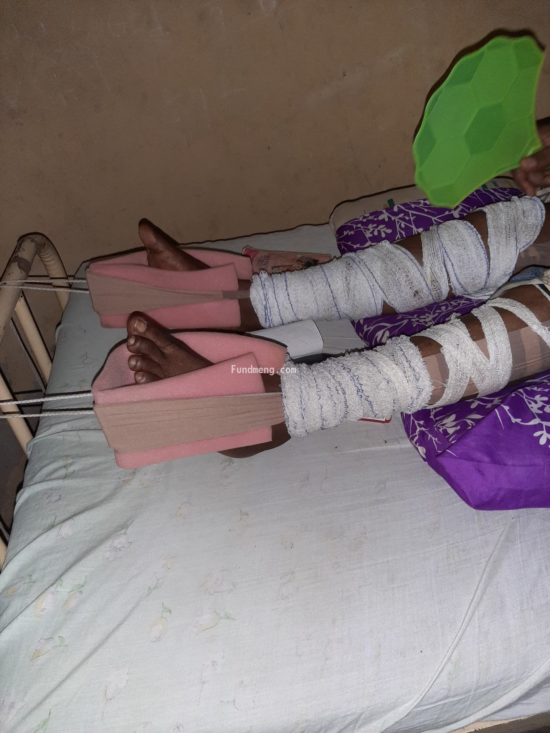 Help MERCY ONGAJI ADESUA Raise Funds To Fight Cervical And Lumber Spondylosis