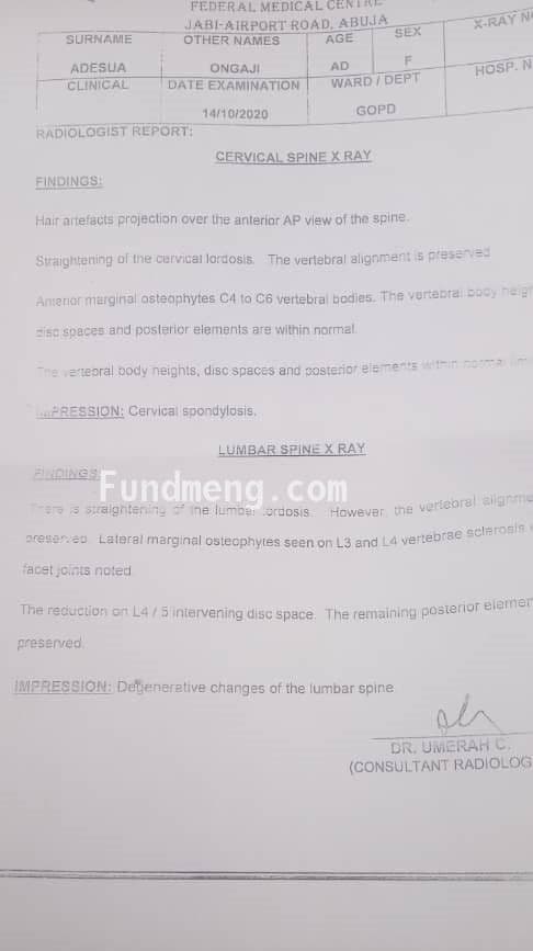 Help MERCY ONGAJI ADESUA Raise Funds To Fight Cervical And Lumber Spondylosis