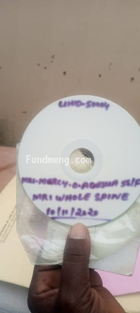 Help MERCY ONGAJI ADESUA Raise Funds To Fight Cervical And Lumber Spondylosis