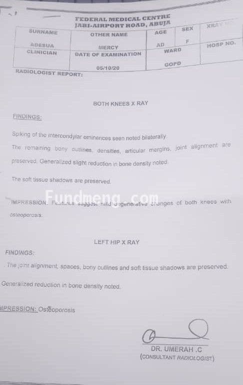 Help MERCY ONGAJI ADESUA Raise Funds To Fight Cervical And Lumber Spondylosis