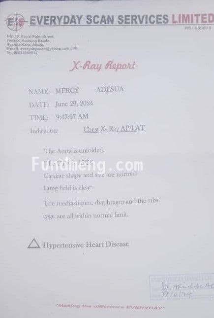 Help MERCY ONGAJI ADESUA Raise Funds To Fight Cervical And Lumber Spondylosis
